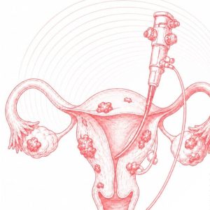 Advanced Course in Endometriosis Surgery